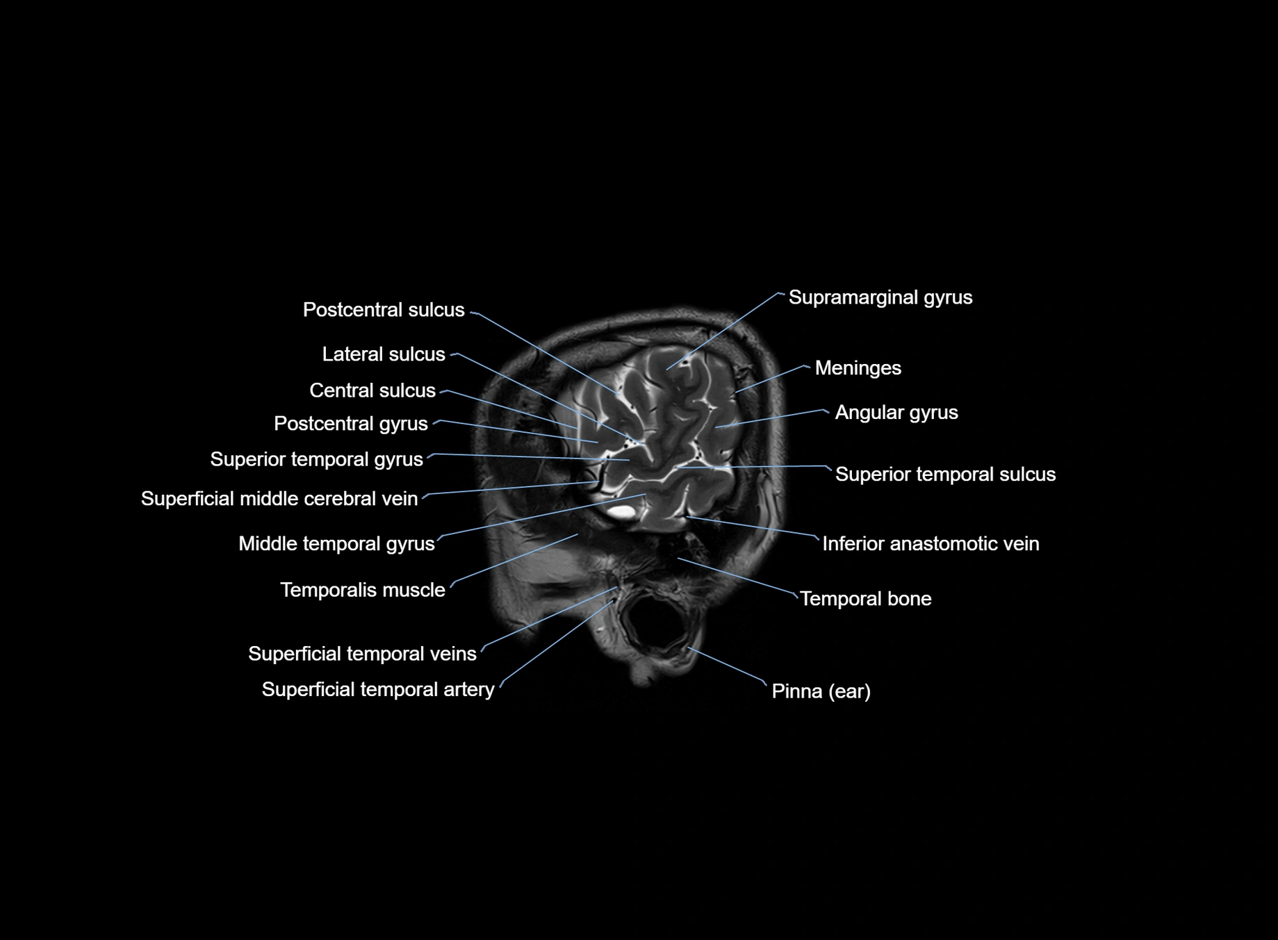 brain sagittal anatomy 3T MRI images -img-00001-00006.webp